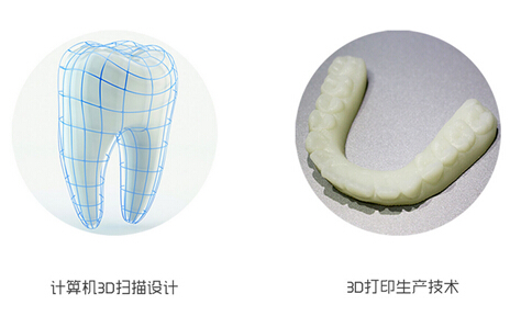 美呀:3D打印为牙齿矫正带来了哪些革新
